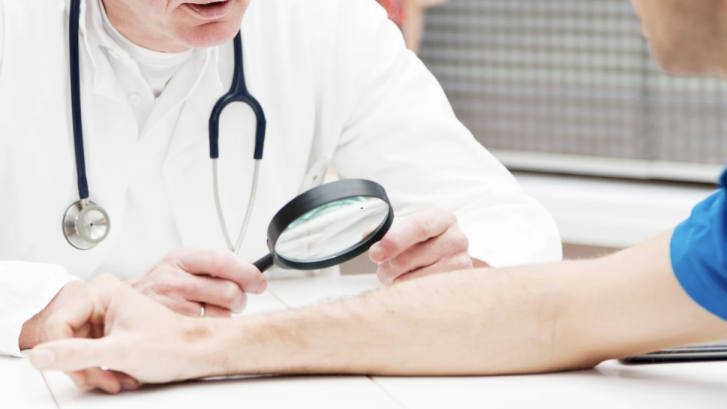 Mole Check and Skin Cancer Exam Near Owings MD